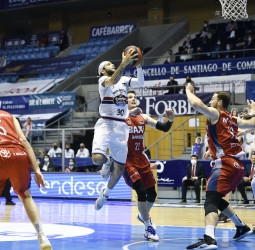 Kassius Robertson será baja para las próximas tres semanas