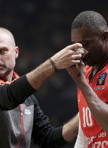 Romain Sato sufre una fractura nasal